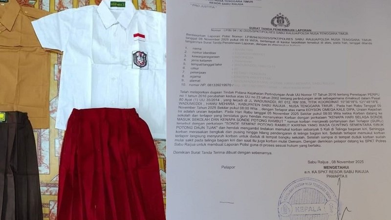 Foto Diduga Aniaya Murid Hingga Masuk Rumah Sakit, Guru SD Di Sabu Raijua Dilaporkan Polisi